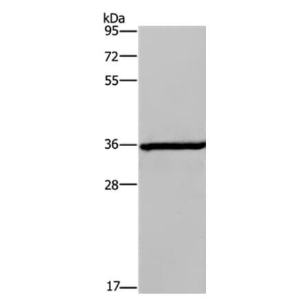 DIO2 Antibody from Signalway Antibody (37535) - Antibodies.com