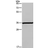 DIO2 Antibody from Signalway Antibody (37535) - Antibodies.com