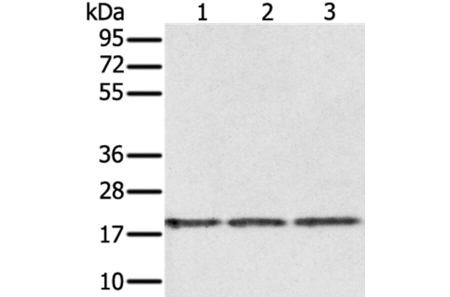 EPGN Antibody from Signalway Antibody (37551) - Antibodies.com