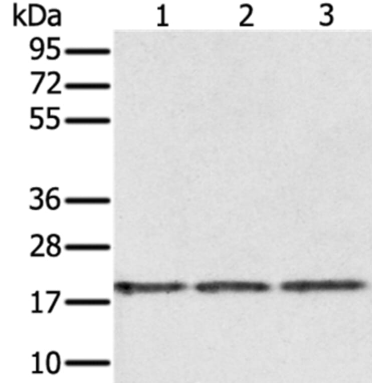 EPGN Antibody from Signalway Antibody (37551) - Antibodies.com