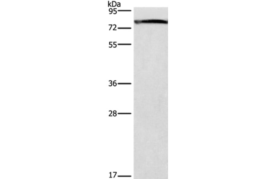 GALC Antibody from Signalway Antibody (37586) - Antibodies.com