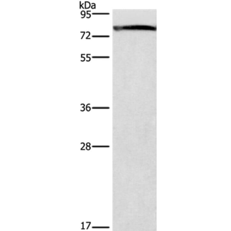GALC Antibody from Signalway Antibody (37586) - Antibodies.com