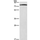 GALC Antibody from Signalway Antibody (37586) - Antibodies.com