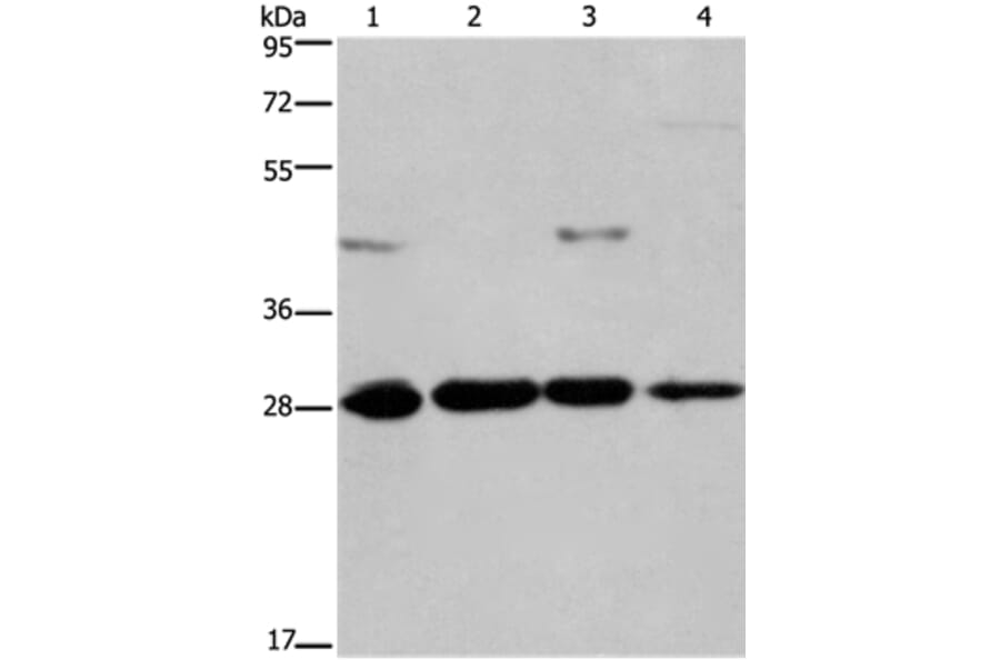 HES1 Antibody from Signalway Antibody (37616) - Antibodies.com