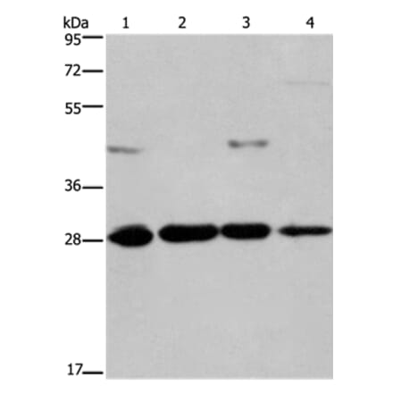 HES1 Antibody from Signalway Antibody (37616) - Antibodies.com