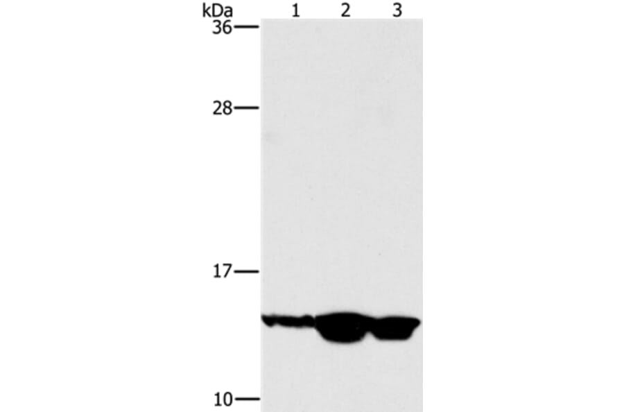 HES5 Antibody from Signalway Antibody (37617) - Antibodies.com