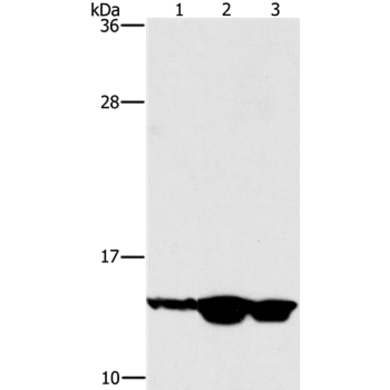 HES5 Antibody from Signalway Antibody (37617) - Antibodies.com