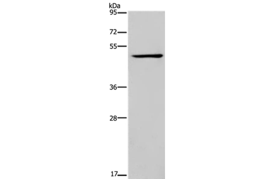 IRF4 Antibody from Signalway Antibody (37663) - Antibodies.com