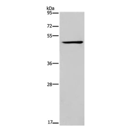 IRF4 Antibody from Signalway Antibody (37663) - Antibodies.com