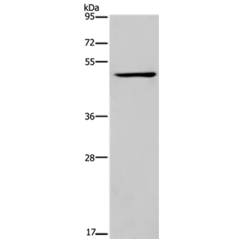 IRF4 Antibody from Signalway Antibody (37663) - Antibodies.com