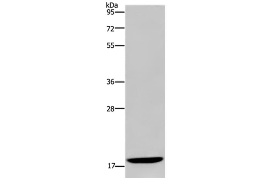 KLLN Antibody from Signalway Antibody (37689) - Antibodies.com