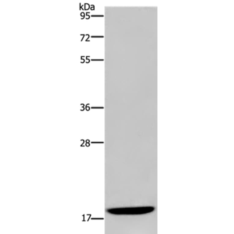 KLLN Antibody from Signalway Antibody (37689) - Antibodies.com
