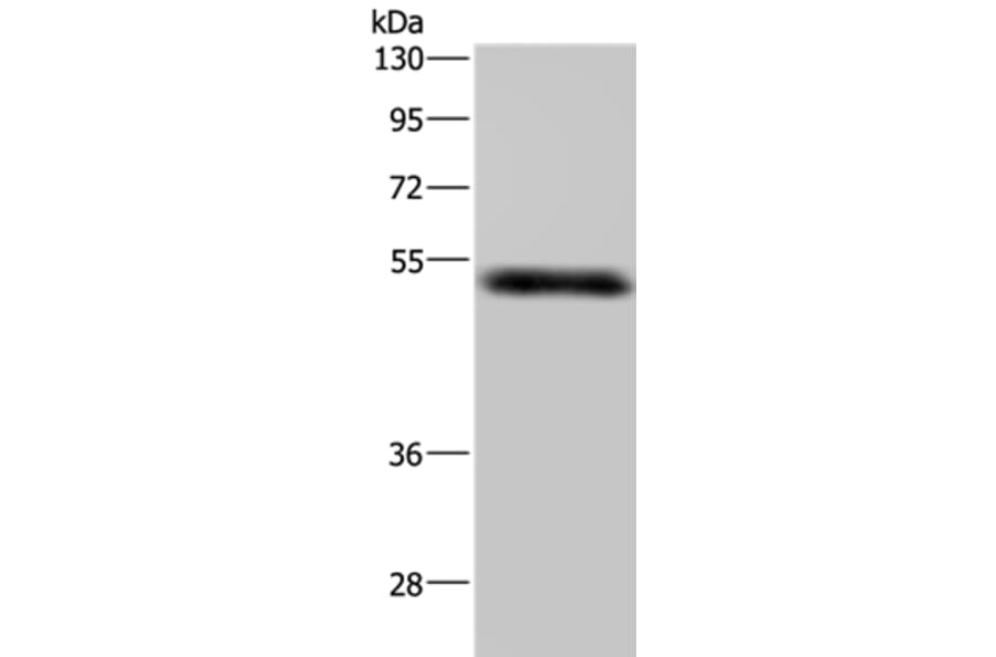 MST4 Antibody from Signalway Antibody (37740) - Antibodies.com