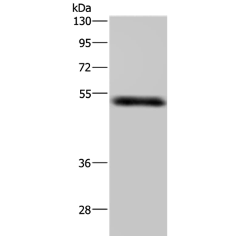 MST4 Antibody from Signalway Antibody (37740) - Antibodies.com