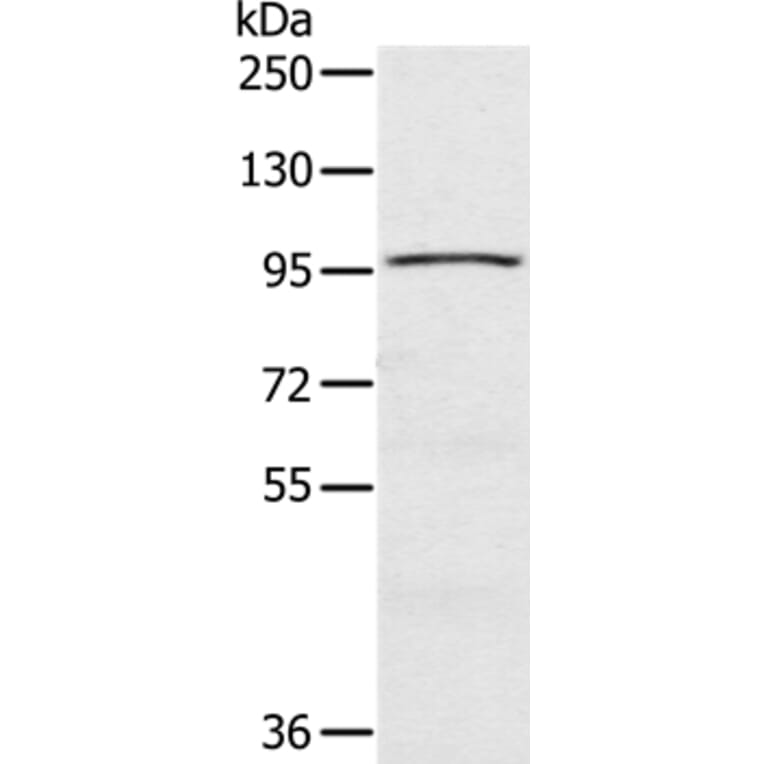 CIZ1 Antibody from Signalway Antibody (37856) - Antibodies.com