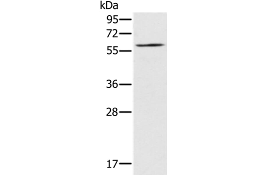 RELB Antibody from Signalway Antibody (37866) - Antibodies.com