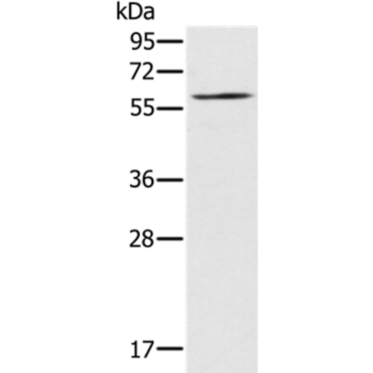 RELB Antibody from Signalway Antibody (37866) - Antibodies.com