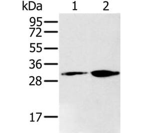 RNLS Antibody from Signalway Antibody (37867) - Antibodies.com
