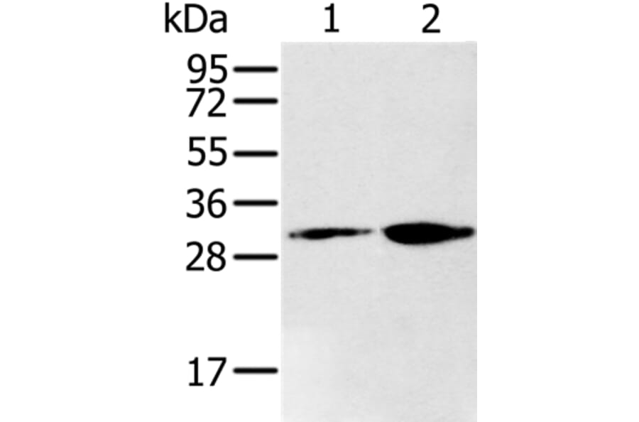 RNLS Antibody from Signalway Antibody (37867) - Antibodies.com