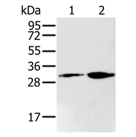 RNLS Antibody from Signalway Antibody (37867) - Antibodies.com