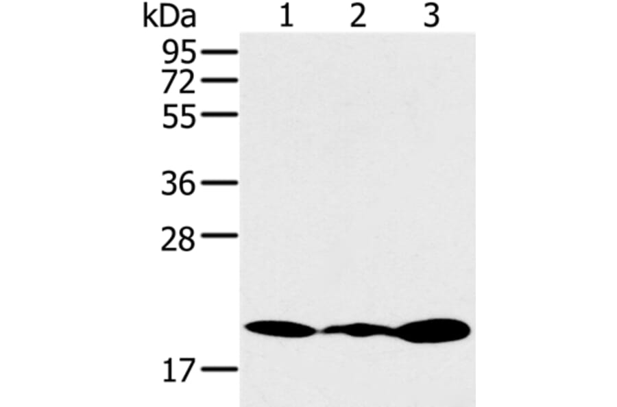 RNF5 Antibody from Signalway Antibody (37869) - Antibodies.com
