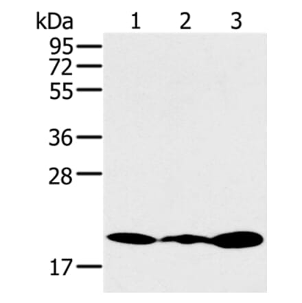 RNF5 Antibody from Signalway Antibody (37869) - Antibodies.com