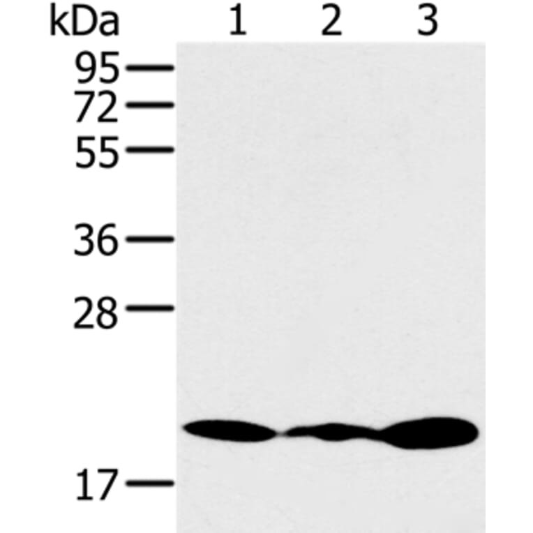 RNF5 Antibody from Signalway Antibody (37869) - Antibodies.com