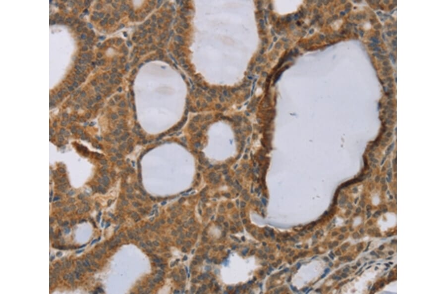 Immunohistochemistry - RNF5 Antibody from Signalway Antibody (37869) - Antibodies.com