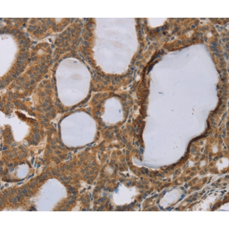 Immunohistochemistry - RNF5 Antibody from Signalway Antibody (37869) - Antibodies.com