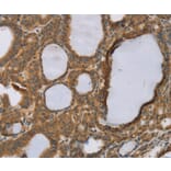 Immunohistochemistry - RNF5 Antibody from Signalway Antibody (37869) - Antibodies.com