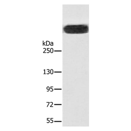 RYR1 Antibody from Signalway Antibody (37887) - Antibodies.com