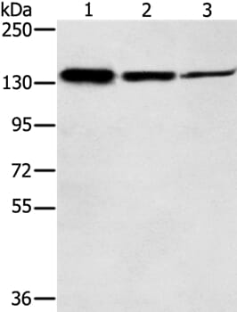 Gel: 6%SDS-PAGE Lysates (from left to right): Jurkat, A172 and A549 cell Amount of lysate: 40ug per lane Primary antibody: 1/300 dilution Secondary antibody dilution: 1/8000 Exposure time: 20 seconds