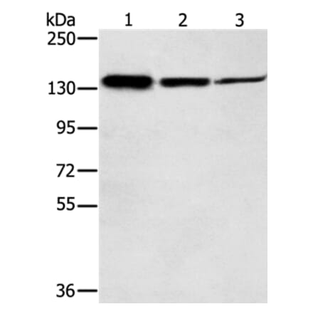 SMC2 Antibody from Signalway Antibody (37956) - Antibodies.com