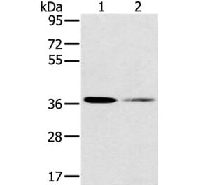 SMN1 Antibody from Signalway Antibody (37959) - Antibodies.com