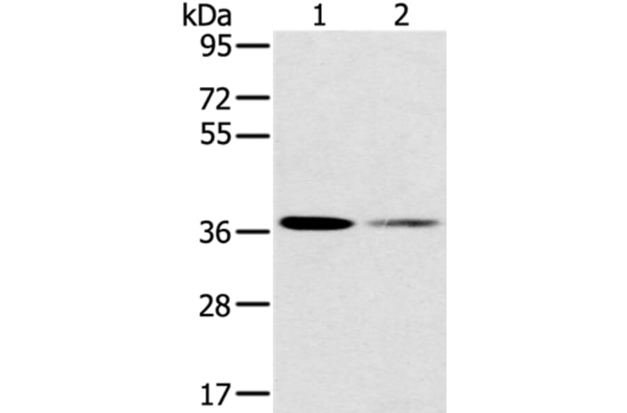 SMN1 Antibody from Signalway Antibody (37959) - Antibodies.com