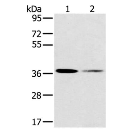 SMN1 Antibody from Signalway Antibody (37959) - Antibodies.com