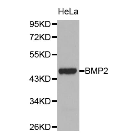 Western blot - BMP2 antibody from Signalway Antibody (38107) - Antibodies.com