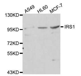 Western blot - IRS1 antibody from Signalway Antibody (38112) - Antibodies.com
