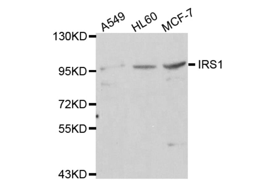 Western blot - IRS1 antibody from Signalway Antibody (38112) - Antibodies.com