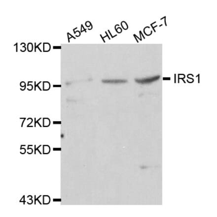Western blot - IRS1 antibody from Signalway Antibody (38112) - Antibodies.com