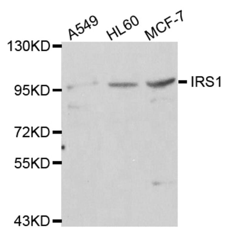 Western blot - IRS1 antibody from Signalway Antibody (38112) - Antibodies.com