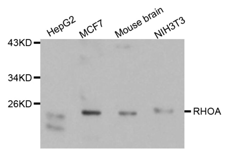 Western blot - RhoA antibody from Signalway Antibody (38121) - Antibodies.com