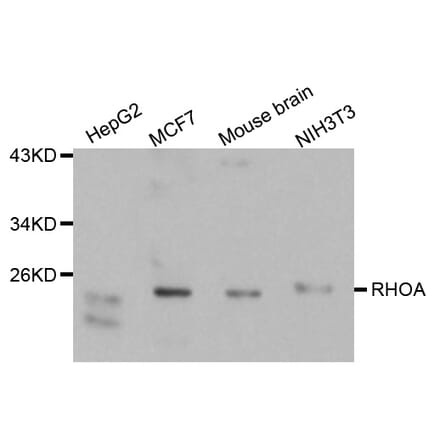 Western blot - RhoA antibody from Signalway Antibody (38121) - Antibodies.com