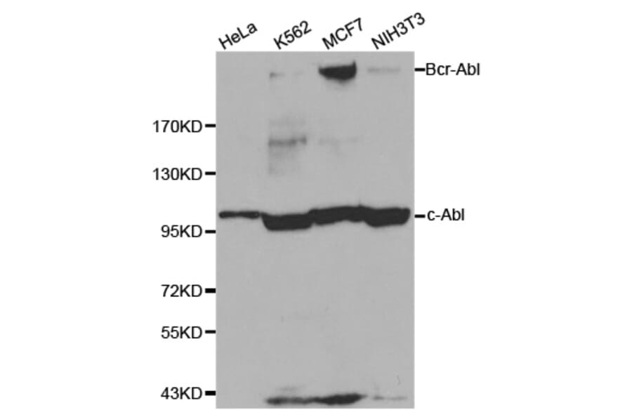Western blot - ABL1 antibody from Signalway Antibody (38124) - Antibodies.com
