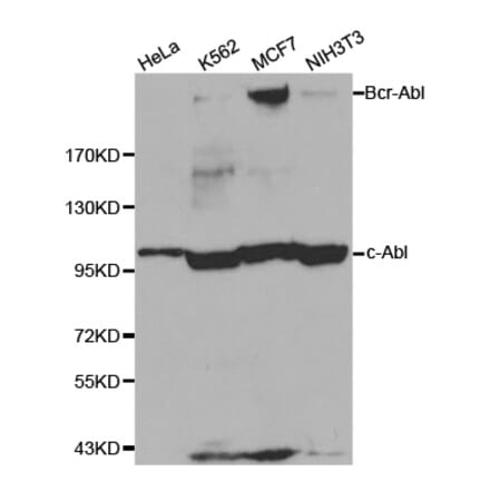 Western blot - ABL1 antibody from Signalway Antibody (38124) - Antibodies.com