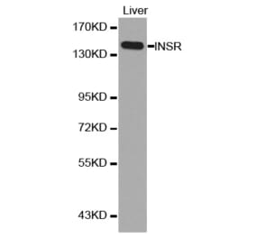 Western blot - INSR antibody from Signalway Antibody (38126) - Antibodies.com