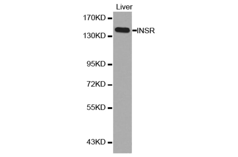 Western blot - INSR antibody from Signalway Antibody (38126) - Antibodies.com