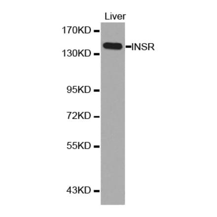 Western blot - INSR antibody from Signalway Antibody (38126) - Antibodies.com