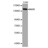 Western blot - INSR antibody from Signalway Antibody (38126) - Antibodies.com