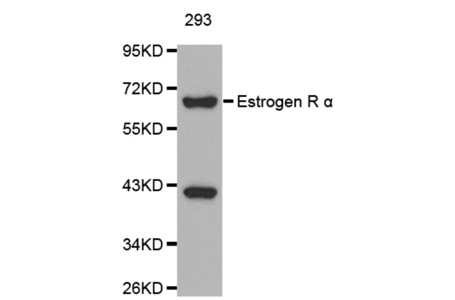 Western blot - ESR1 antibody from Signalway Antibody (38128) - Antibodies.com